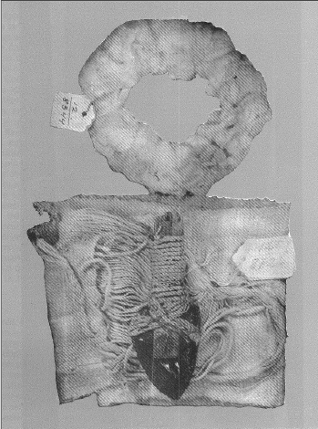 Inca Shamanic Glossary - Appendix L, Pre-Conquest Surgical Tools